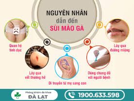 Hình ảnh minh họa